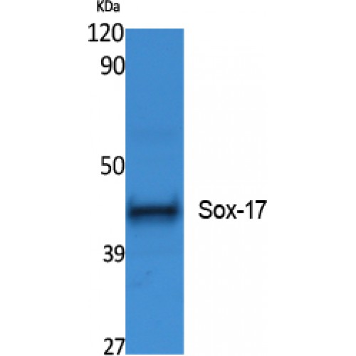 SOX17 Antibody - Western blot of Sox-17 antibody