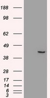 SOX17 Antibody - HEK293T cells were transfected with the pCMV6-ENTRY control (Left lane) or pCMV6-ENTRY SOX17 (Right lane) cDNA for 48 hrs and lysed. Equivalent amounts of cell lysates (5 ug per lane) were separated by SDS-PAGE and immunoblotted with anti-SOX17.