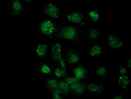 SOX17 Antibody - Immunofluorescent staining of HeLa cells using anti-SOX17 mouse monoclonal antibody.