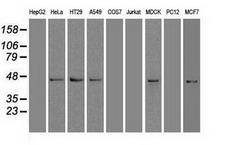 SOX17 Antibody - Anti-SOX17 mouse monoclonal antibody  immunofluorescent staining of HeLa cells transiently transfected by pCMV6-ENTRY SOX17.
