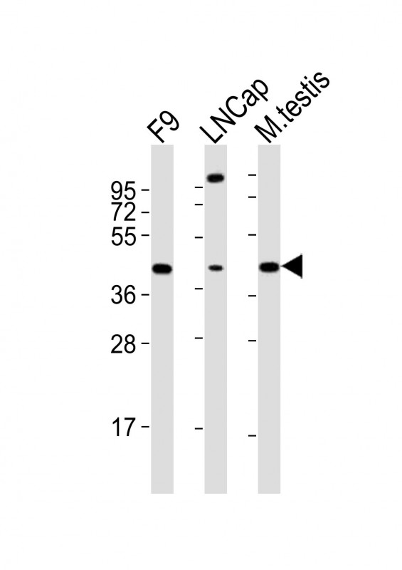 SOX17 Antibody - All lanes : Anti-Sox17 Antibody at 1:2000 dilution Lane 1: F9 whole cell lysates Lane 2: LNCap whole cell lysates Lane 3: mouse testis lysates Lysates/proteins at 20 ug per lane. Secondary Goat Anti-Rabbit IgG, (H+L), Peroxidase conjugated at 1/10000 dilution Predicted band size : 45 kDa Blocking/Dilution buffer: 5% NFDM/TBST.