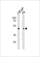 SOX17 Antibody - Western blot of lysates from LNCaP, mouse F9 cell line (from left to right) with Sox17 Antibody. Antibody was diluted at 1:1000 at each lane. A goat anti-rabbit IgG H&L (HRP) at 1:10000 dilution was used as the secondary antibody. Lysates at 20 ug per lane.