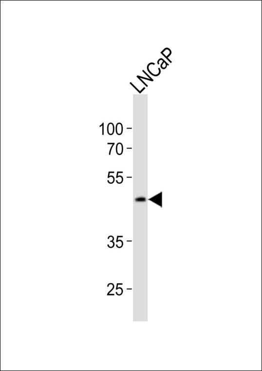 SOX17 Antibody - Western blot of lysate from LNCaP cell line, using Sox17 antibody diluted at 1:1000. A goat anti-rabbit IgG H&L (HRP) at 1:10000 dilution was used as the secondary antibody. Lysate at 20 ug.