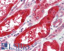 SOX17 Antibody - Anti-SOX17 antibody IHC of human kidney. Immunohistochemistry of formalin-fixed, paraffin-embedded tissue after heat-induced antigen retrieval. Antibody concentration 5 ug/ml.  This image was taken for the unconjugated form of this product. Other forms have not been tested.