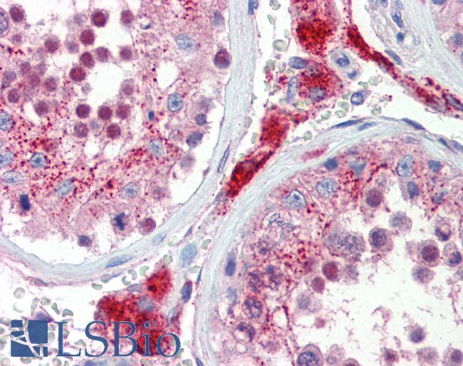SOX17 Antibody - Anti-SOX17 antibody IHC of human testis. Immunohistochemistry of formalin-fixed, paraffin-embedded tissue after heat-induced antigen retrieval. Antibody concentration 5 ug/ml.  This image was taken for the unconjugated form of this product. Other forms have not been tested.