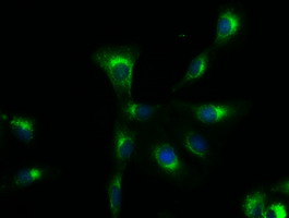 SOX17 Antibody - Immunofluorescent staining of A549 cells using anti-SOX17 mouse monoclonal antibody.