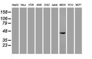 SOX17 Antibody - Immunofluorescent staining of A549 cells using anti-SOX17 mouse monoclonal antibody.