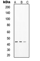 SOX17 Antibody - Western blot analysis of SOX17 expression in HeLa (A); LNCaP (B); DU145 (C) whole cell lysates.