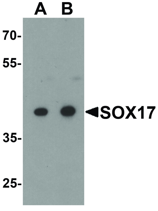 SOX17 Antibody - Western blot analysis of SOX17 in HepG2 cell lysate with SOX17 antibody at (A) 0.5 and (B) 1 ug/ml.