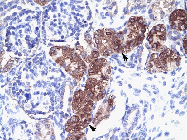 SOX18 Antibody - SOX18 antibody ARP33056_P050-NP_060889-SOX18 (SRY (sex determining region Y)-box 18) Antibody was used in IHC to stain formalin-fixed, paraffin-embedded human kidney.  This image was taken for the unconjugated form of this product. Other forms have not been tested.