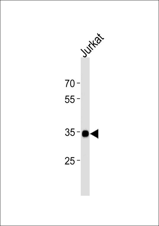 SOX18 Antibody - SOX18 Antibody western blot of Jurkat cell line lysates (35 ug/lane). The SOX18 antibody detected the SOX18 protein (arrow).