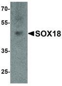 SOX18 Antibody - Western blot analysis of SOX18 in 3T3 cell lysate with SOX18 antibody at 1 ug/ml.