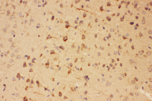 SOX2 Antibody - SOX2 antibody. IHC(P): Mouse Brain Tissue.
