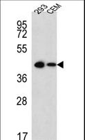 SOX2 Antibody - Sox2-pS246-pS249-pS250--pS251 Antibody western blot of 293,CEM cell line lysates (15 ug/lane). The Sox2 antibody detected the Sox2 protein (arrow).