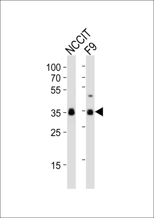 SOX2 Antibody - Western blot of lysates from NCCIT, mouse F9 cell line (from left to right), using SOX2 antibody diluted at 1:1000 at each lane. A goat anti-rabbit IgG H&L (HRP) at 1:10000 dilution was used as the secondary antibody. Lysates at 20 ug per lane.