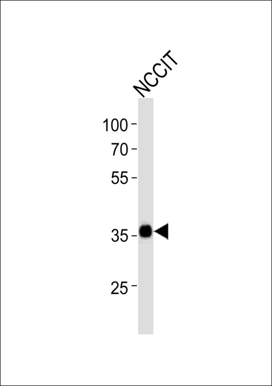 SOX2 Antibody - Western blot of lysate from NCCIT cell line with SOX2 Antibody. Antibody was diluted at 1:1000. A goat anti-rabbit IgG H&L (HRP) at 1:10000 dilution was used as the secondary antibody. Lysate at 20 ug.