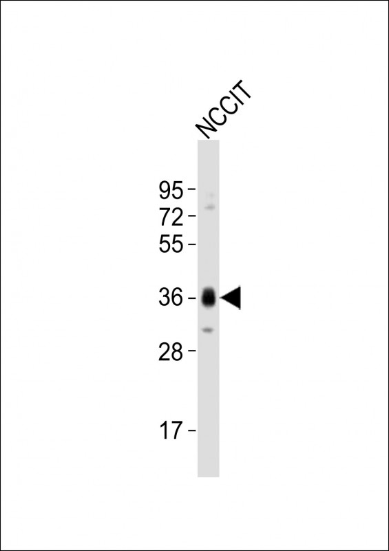 SOX2 Antibody - Anti- (Mouse) Sox2 Antibody at 1:1000 dilution + NCCIT whole cell lysates Lysates/proteins at 20 ug per lane. Secondary Goat Anti-Rabbit IgG, (H+L), Peroxidase conjugated at 1/10000 dilution Predicted band size :34 kDa Blocking/Dilution buffer: 5% NFDM/TBST.