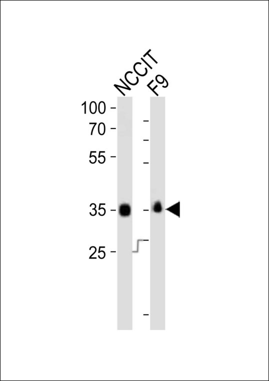 SOX2 Antibody - Western blot of lysates from NCCIT, mouse F9 cell line (from left to right) with Sox2 Antibody. Antibody was diluted at 1:1000 at each lane. A goat anti-rabbit IgG H&L (HRP) at 1:10000 dilution was used as the secondary antibody. Lysates at 20 ug per lane.