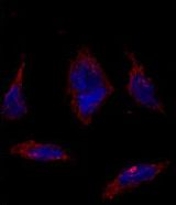 SOX2 Antibody - Immunofluorescence of SOX2 Antibody in HeLa cells. 0.025 mg/ml primary antibody was followed by Alexa-Fluor-546-conjugated donkey anti-rabbit lgG (H+L). Alexa-Fluor-546 emits orange fluorescence. Blue counterstaining is DAPI.