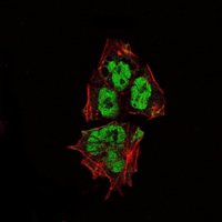 SOX2 Antibody - Immunofluorescence of NTERA-2 cells using SOX2 mouse monoclonal antibody (green). Red: Actin filaments have been labeled with Alexa Fluor-555 phalloidin.