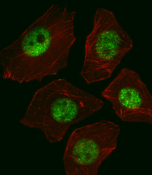 SOX2 Antibody - Fluorescent image of A549 cell stained with SOX2 Antibody. A549 cells were fixed with 4% PFA (20 min), permeabilized with Triton X-100 (0.1%, 10 min), then incubated with SOX2 primary antibody (1:25, 1 h at 37°C). For secondary antibody, Alexa Fluor 488 conjugated donkey anti-mouse antibody (green) was used (1:400, 50 min at 37°C). Cytoplasmic actin was counterstained with Alexa Fluor 555 (red) conjugated Phalloidin (7units/ml, 1 h at 37°C). SOX2 immunoreactivity is localized to Nucleus significantly.