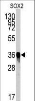 SOX2 Antibody - Western blot of SOX2 Antibody by SOX2 recombinant protein. SOX2(arrow) was detected using the purified antibody.