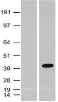 SOX2 Antibody - HEK293T cells were transfected with the pCMV6-ENTRY control. (Left lane) or pCMV6-ENTRY SOX2. (Right lane) cDNA for 48 hrs and lysed