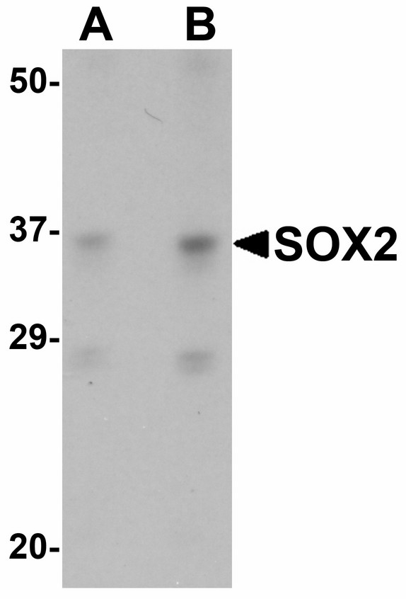 SOX2 Antibody - Western blot of SOX2 in 3T3 cell lysate with SOX2 antibody at (A) 1 and (B) 2 ug/ml.