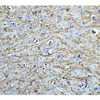 SOX2 Antibody - Immunohistochemistry of SOX2 in mouse brain tissue with SOX2 Antibodyat 5 µg/mL.