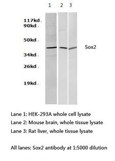 SOX2 Antibody - Western blot of sox2 pAb in extracts from HEK-293A cells,mouse brain and rat liver tissues.