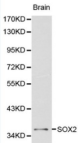 SOX2 Antibody - Western blot of SOX2 pAb in extracts from mouse brain tissue.