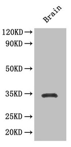 SOX2 Antibody - Western Blot Positive WB detected in: Mouse brain tissue All lanes: SOX2 antibody at 3.5µg/ml Secondary Goat polyclonal to rabbit IgG at 1/50000 dilution Predicted band size: 34 kDa Observed band size: 34 kDa