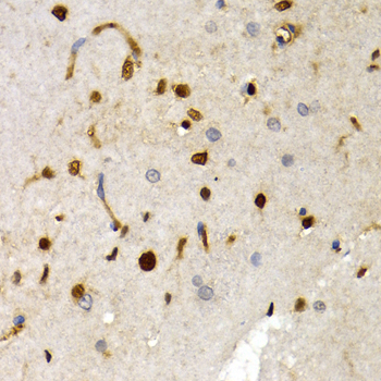 SOX2 Antibody - Immunohistochemistry of paraffin-embedded rat brain using SOX2 antibodyat dilution of 1:200 (40x lens).