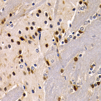 SOX2 Antibody - Immunohistochemistry of paraffin-embedded mouse brain using SOX2 antibodyat dilution of 1:200 (40x lens).