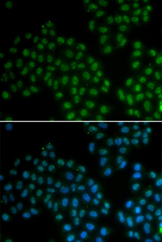 SOX2 Antibody - Immunofluorescence analysis of A549 cells using SOX2 antibody.