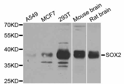 SOX2 Antibody - Western blot analysis of extracts of various cell lines, using SOX2 antibody at 1:1000 dilution. The secondary antibody used was an HRP Goat Anti-Rabbit IgG (H+L) at 1:10000 dilution. Lysates were loaded 25ug per lane and 3% nonfat dry milk in TBST was used for blocking. An ECL Kit was used for detection and the exposure time was 90s.