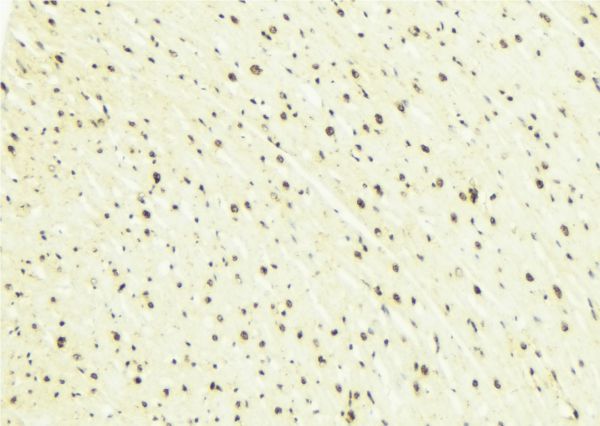 SOX2 Antibody - 1:100 staining mouse brain tissue by IHC-P. The sample was formaldehyde fixed and a heat mediated antigen retrieval step in citrate buffer was performed. The sample was then blocked and incubated with the antibody for 1.5 hours at 22°C. An HRP conjugated goat anti-rabbit antibody was used as the secondary.