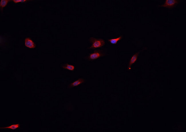 SOX2 Antibody - Staining U251 MG cells by IF/ICC. The samples were fixed with PFA and permeabilized in 0.1% Triton X-100, then blocked in 10% serum for 45 min at 25°C. The primary antibody was diluted at 1:200 and incubated with the sample for 1 hour at 37°C. An Alexa Fluor 594 conjugated goat anti-rabbit IgG (H+L) antibody, diluted at 1/600, was used as secondary antibody.