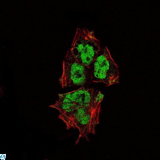 SOX2 Antibody - Immunofluorescence (IF) analysis of NTERA-2 cells using SOX-2 Monoclonal Antibody (green). Red: Actin filaments have been labeled with Alexa Fluor-555 phalloidin.
