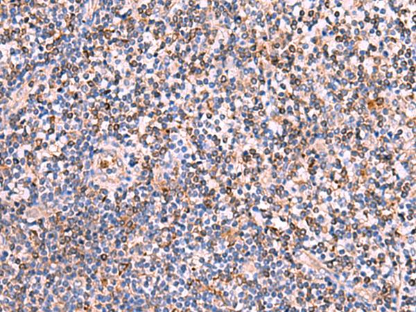 SOX2 Antibody - Immunohistochemistry of paraffin-embedded Human tonsil tissue  using SOX2 Polyclonal Antibody at dilution of 1:35(×200)