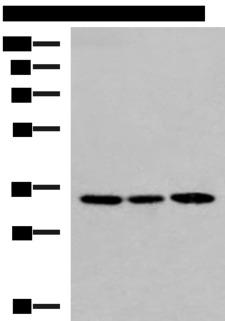 SOX2 Antibody - Western blot analysis of 293T and HepG2 cell lysates  using SOX2 Polyclonal Antibody at dilution of 1:800