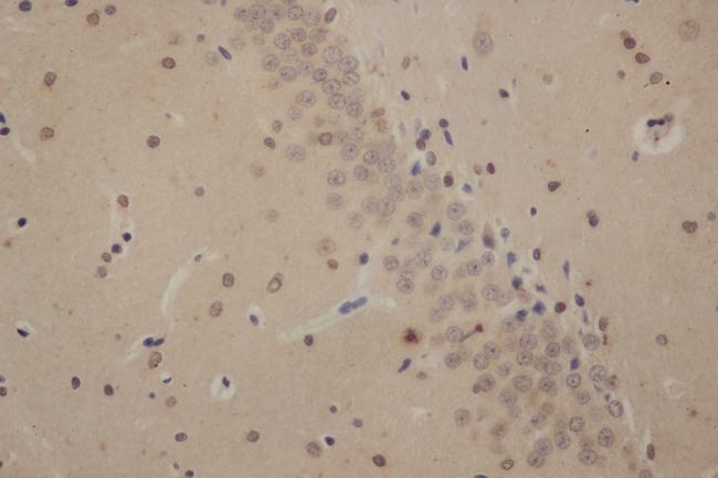 SOX2 Antibody - Immunohistochemistry of paraffin-embedded Rat brain using SOX-2 Polyclonal Antibody at dilution of 1:50.