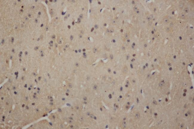 SOX2 Antibody - Immunohistochemistry of paraffin-embedded Mouse brain using SOX-2 Polyclonal Antibody at dilution of 1:50.