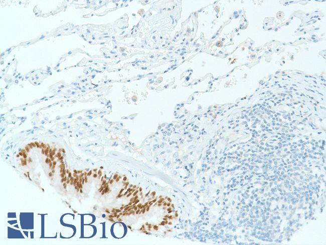 SOX2 Antibody - Immunohistochemistry of Human lung stained with anti-sox-2 antibody