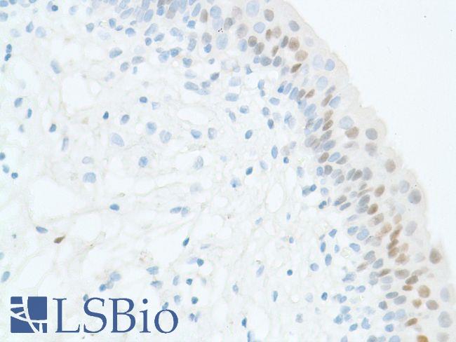 SOX2 Antibody - Immunohistochemistry of Human Bladder stained with anti-Sox-2 antibody