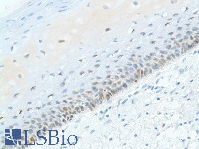 SOX2 Antibody - Immunohistochemistry of Human Cervix stained with anti-Sox-2 antibody