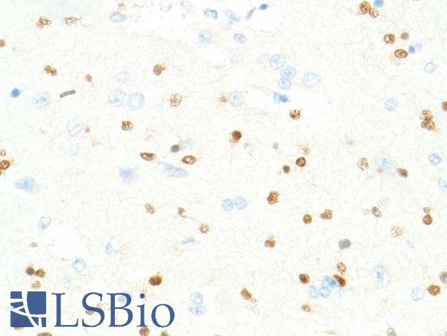 SOX2 Antibody - Immunohistochemistry of Human Spinal Cord stained with anti-Sox-2 antibody