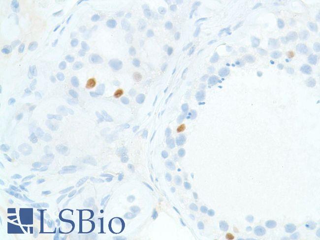 SOX2 Antibody - Immunohistochemistry of Human Testis stained with anti-Sox-2 antibody