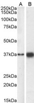 SOX2 Antibody - 0.3µg/ml staining of MCF7 nuclear (A) and U251 (B) cell lysate (35µg protein in RIPA buffer). Detected by chemiluminescence.