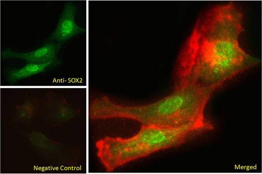 SOX2 Antibody - Immunofluorescence analysis of paraformaldehyde fixed U251 cells, permeabilized with 0.15% Triton. Primary incubation 1hr (10ug/ml) followed by Alexa Fluor 488 secondary antibody (2ug/ml), showing nuclear staining. Actin filaments were stained with phalloidin (red). Negative control: Unimmunized goat IgG (10ug/ml) followed by Alexa Fluor 488 secondary antibody (2ug/ml).